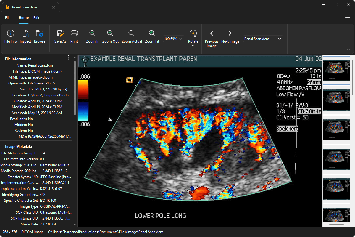 how to view a dcm file